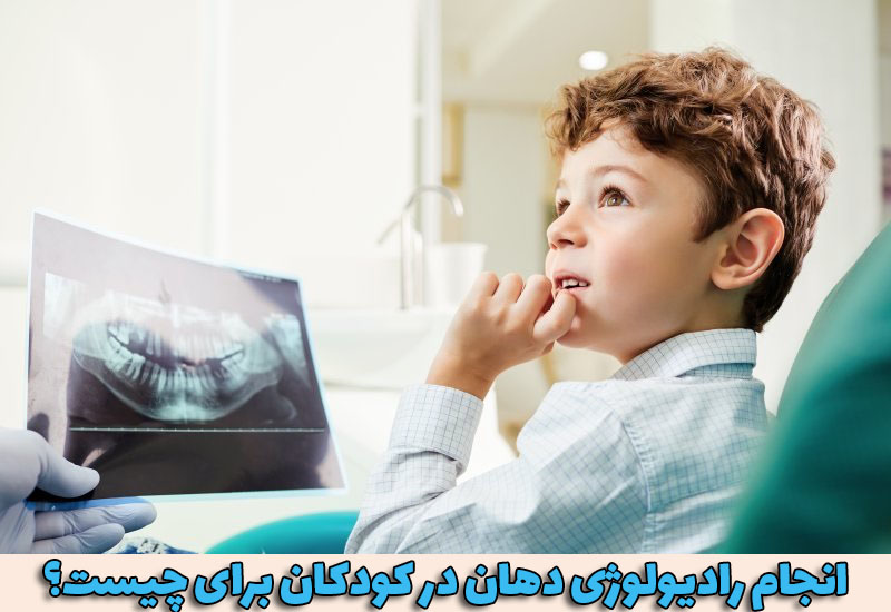 انجام رادیولوژی دهان در کودکان برای چیست؟